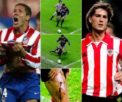 Así quedó la rodilla de Julen tras el pisotón de Simeone.