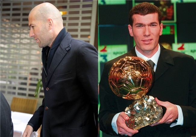 Zidane ha perdido el pelo que tenía.