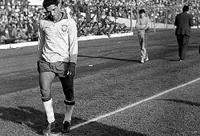 Garrincha tenía problemas en la columna y cojeaba ostensiblemente.