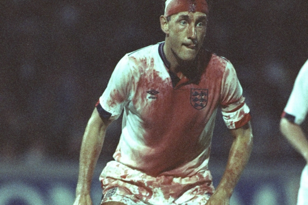 Así jugo prácticamente todo el partido Terry Butcher en 1989.