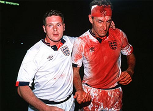 Terry Butcher lleno de sangre en 1989