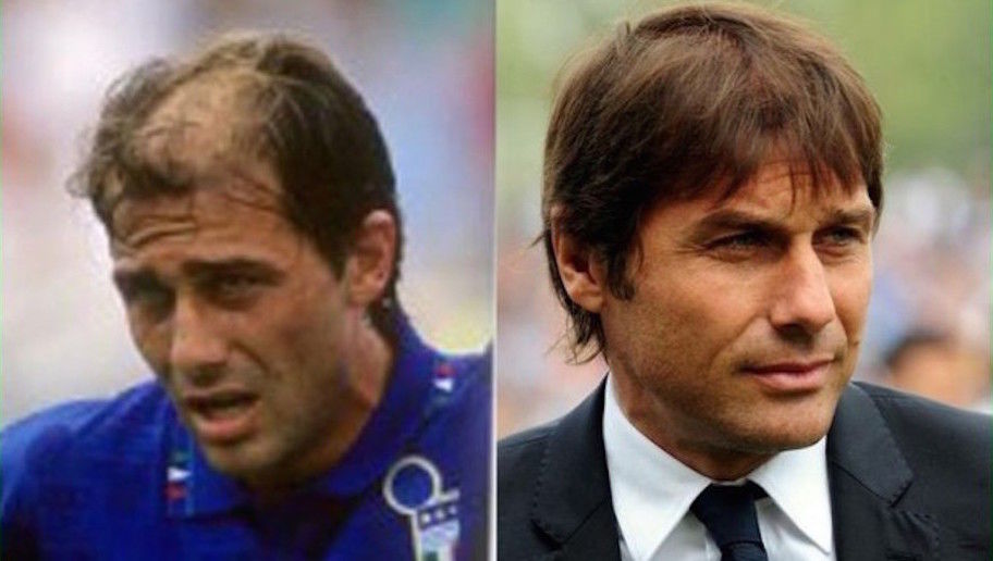 recuperaron el pelo 