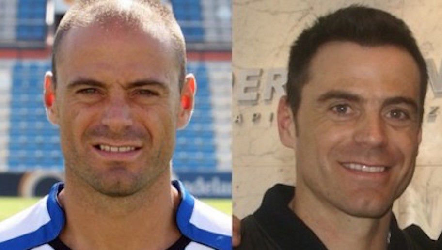jugadores que recuperaron el pelo 